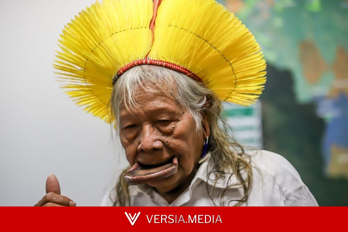 Cacique Raoni tem hemorragia digestiva, mas quadro é estável
